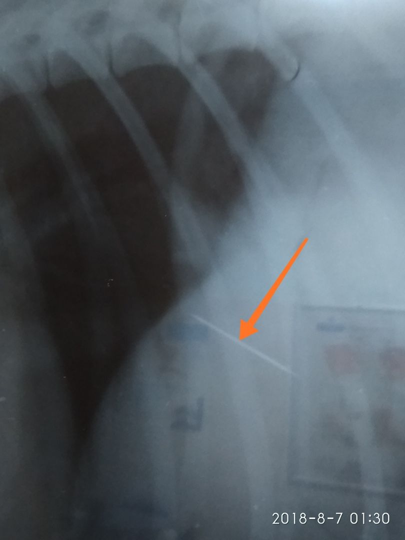 ofiCtEXORVw.jpg ofiCtEXORVw.jpg