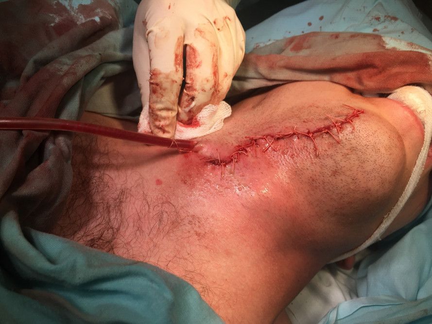 img_7130-16-08-18-03-52.jpg img_7130-16-08-18-03-52.jpg