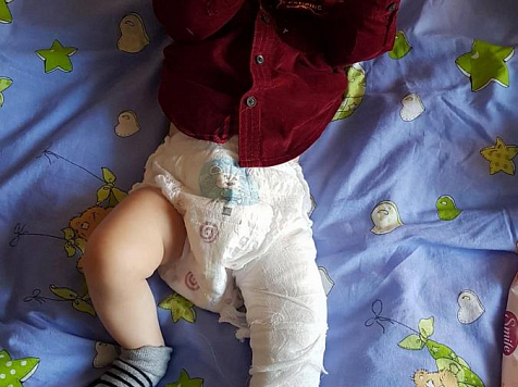 После массажа в поликлинике Ветлужанки 7-месячному младенцу наложили гипс на всю ногу (фото). Фото: Денис Марлинский / facebook.com