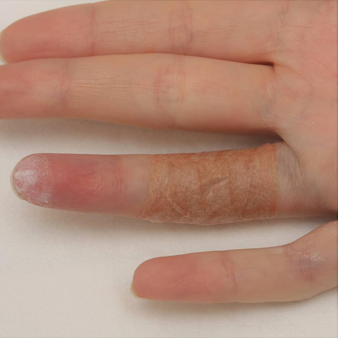 клык кота красноярск хирург кеосьян.jpg клык кота красноярск хирург кеосьян.jpg