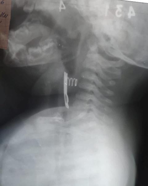 Рентген.jpg Рентген.jpg