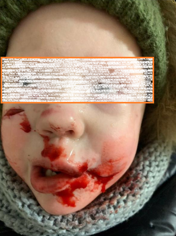 Собака 5.png Собака 5.png