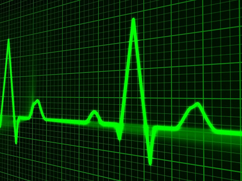 Красноярцам 40+ медики рекомендовали ежегодно проверять сердце. Фото: pixabay.com