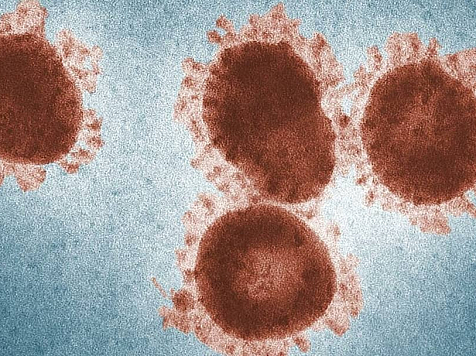Еще 25 человек скончались от коронавируса в Красноярском крае за сутки. Фото: pixabay.com